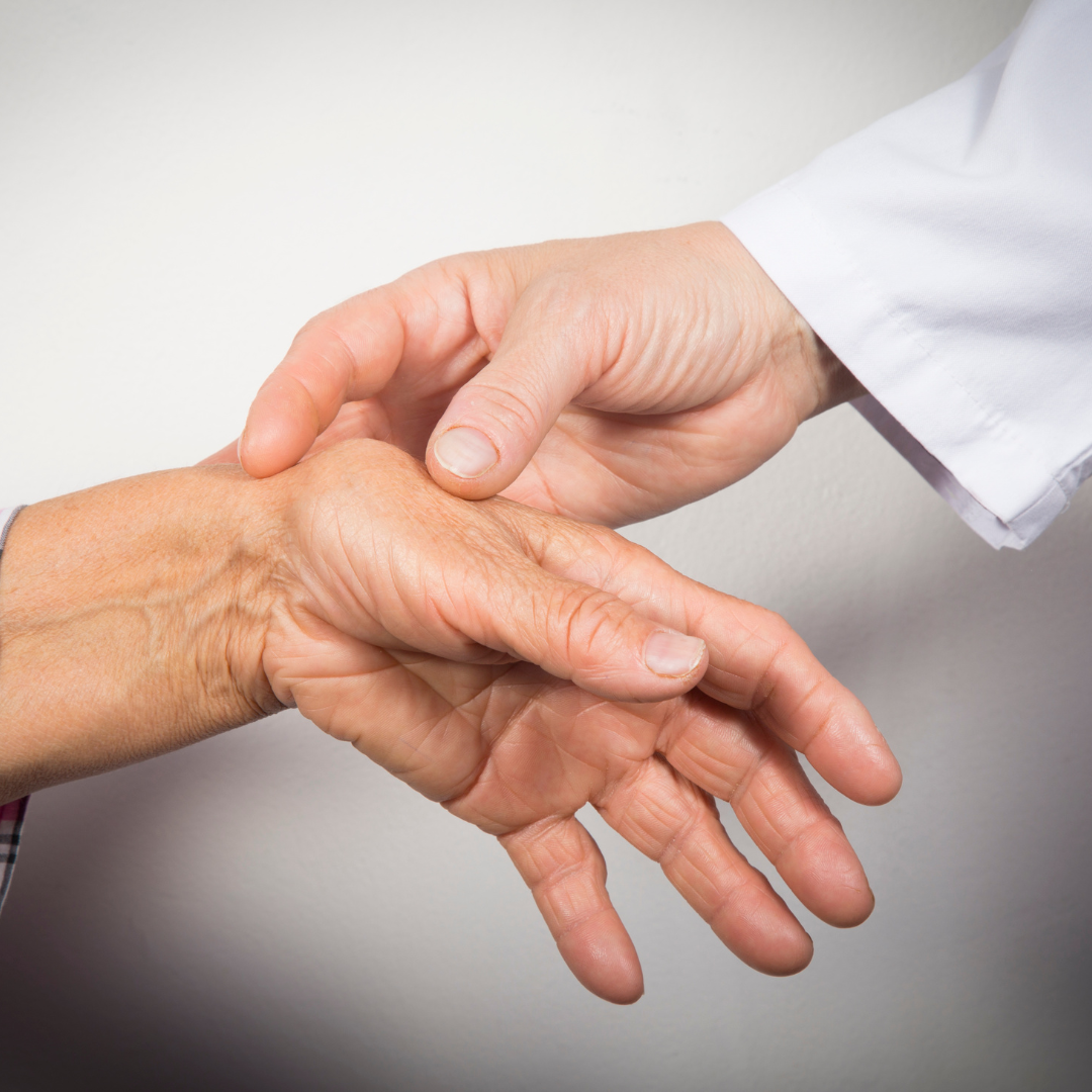 Rheumatoid arthritis, what benefits from Omega3s?